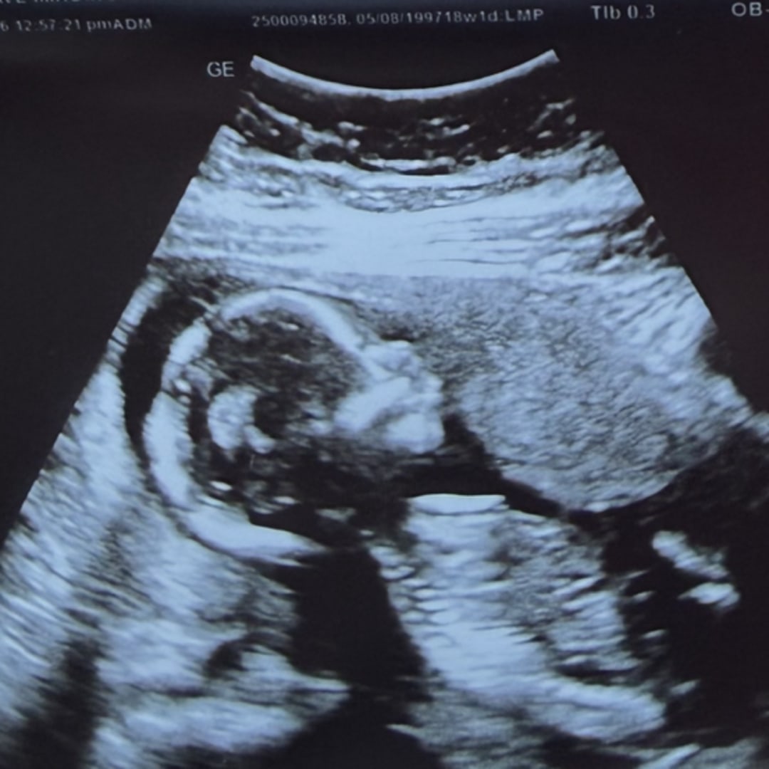 Photo shared by Grace for their Babylist baby registry.