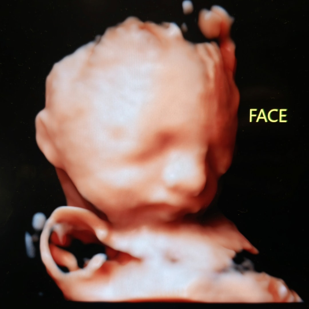 Photo shared by Carmela for their Babylist baby registry.