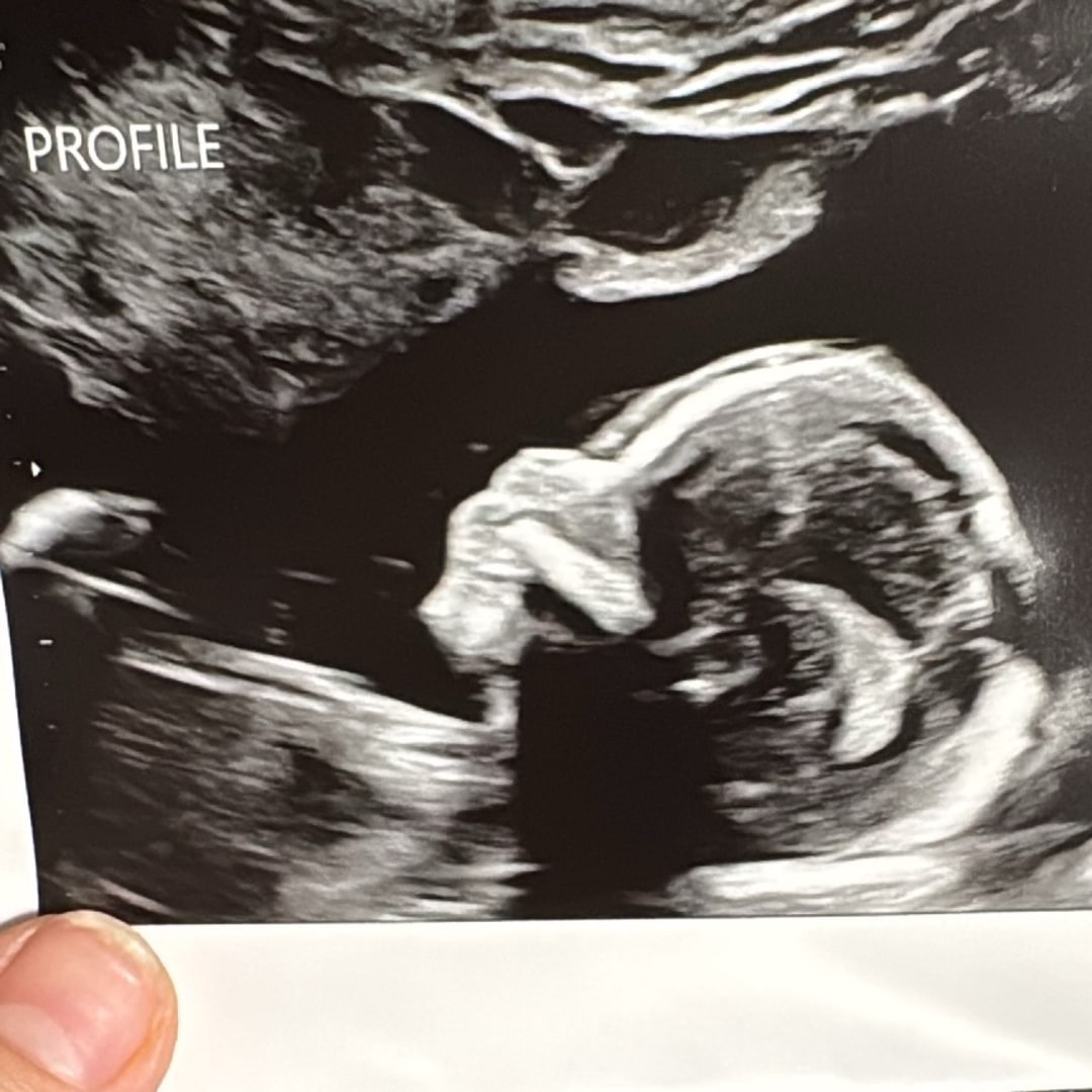 Photo shared by Hannah for their Babylist baby registry.