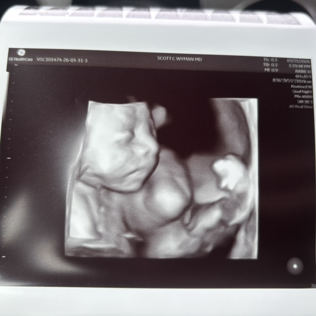 Photo shared by Brookelynn for their Babylist baby registry.