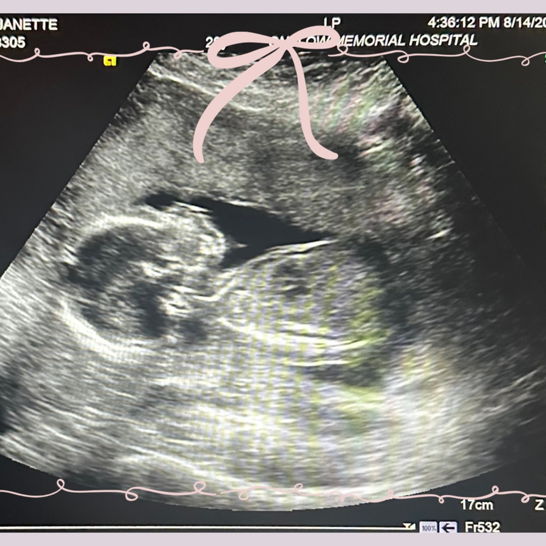 Photo shared by Janette for their Babylist baby registry.