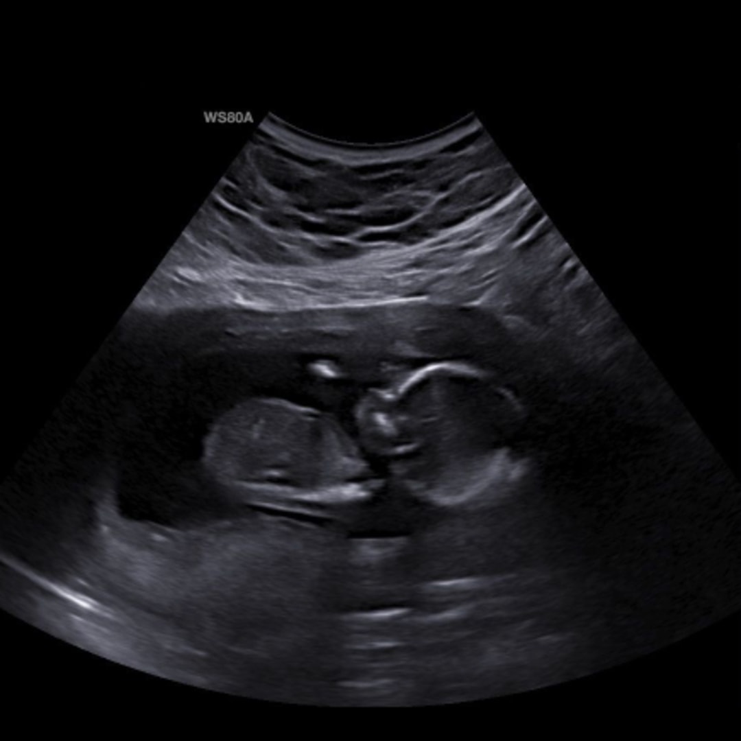 Photo shared by Courtney for their Babylist baby registry.