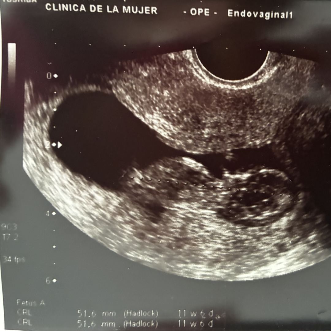 Photo shared by JULI & SANTI for their Babylist baby registry.