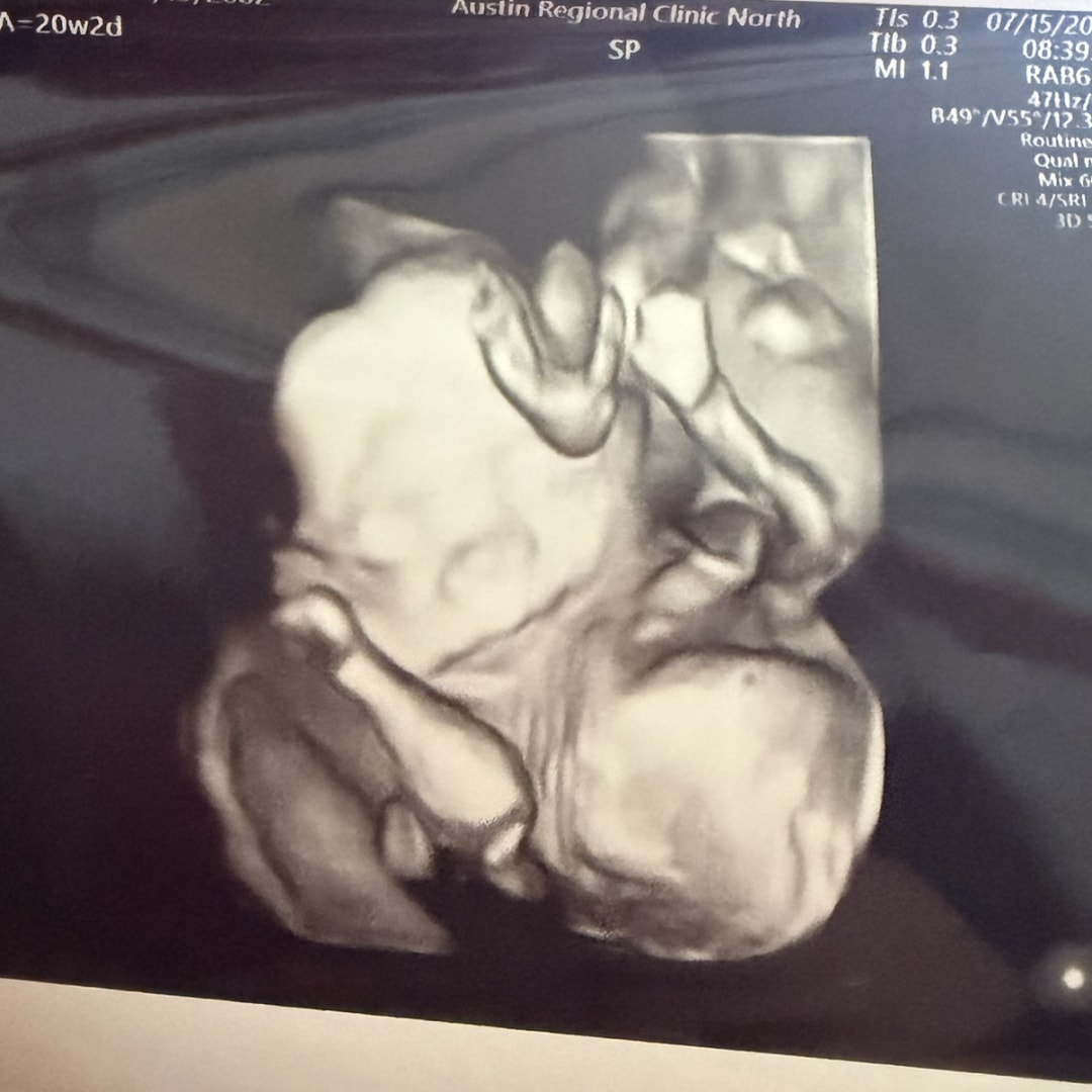Photo shared by Haley for their Babylist baby registry.