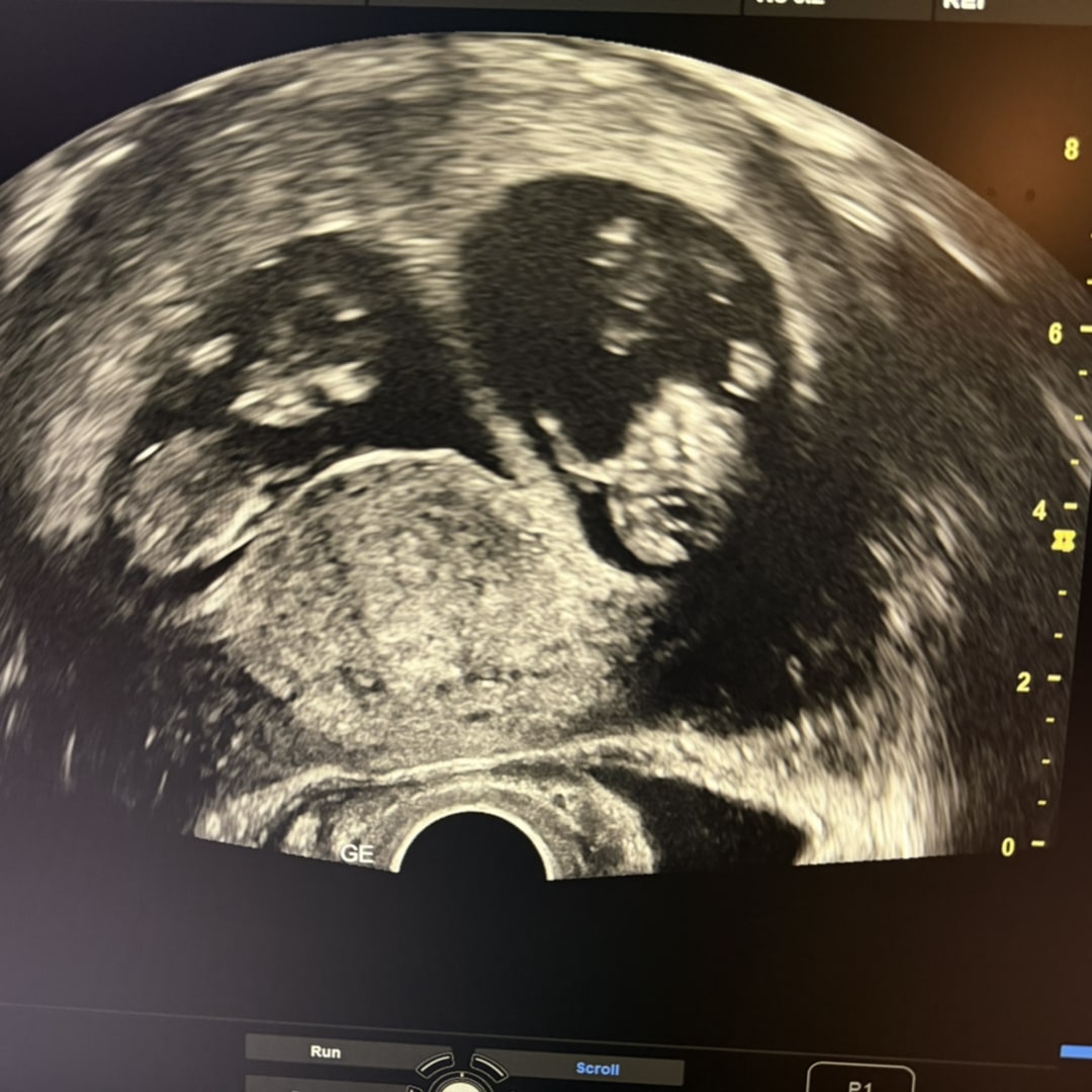 Photo shared by Tashema for their Babylist baby registry.