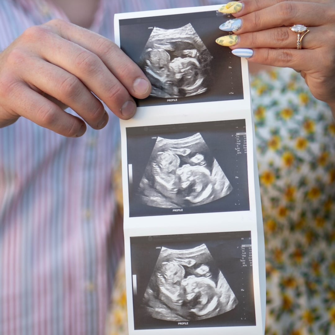 Photo shared by Katy for their Babylist baby registry.