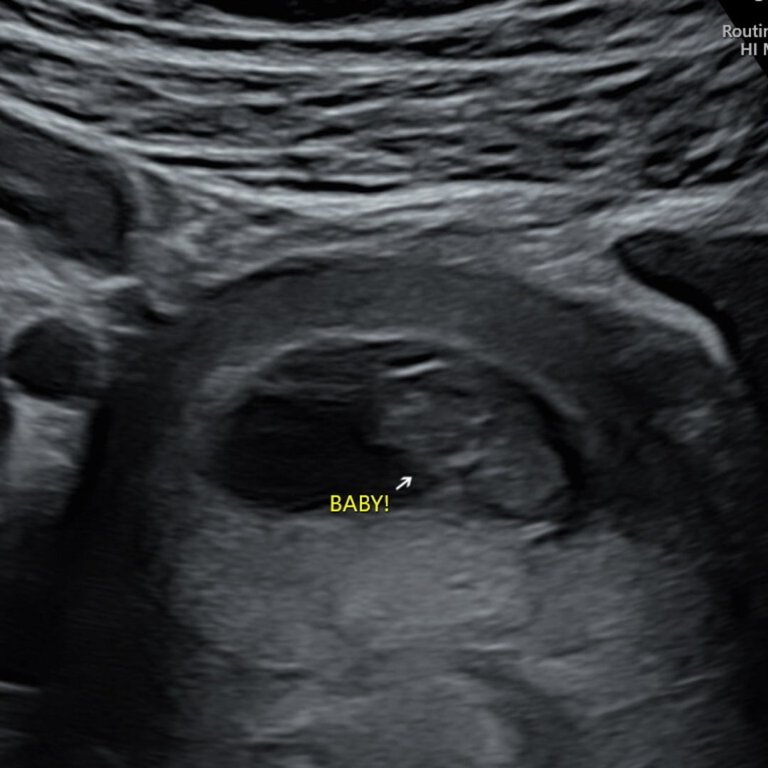 Photo shared by Katelyn for their Babylist baby registry.