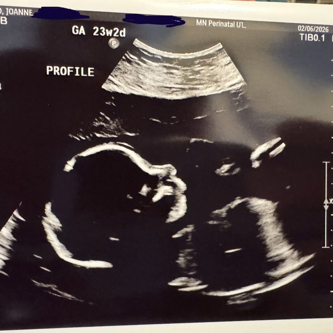 Photo shared by Joanne for their Babylist baby registry.