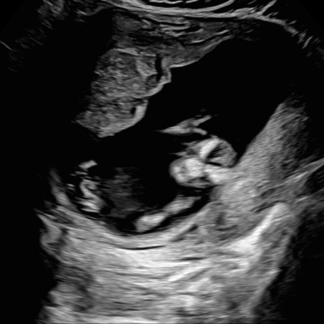 Photo shared by Catarina for their Babylist baby registry.