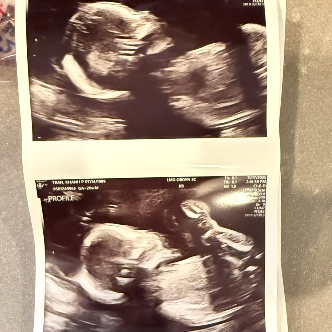 Photo shared by Khanh for their Babylist baby registry.