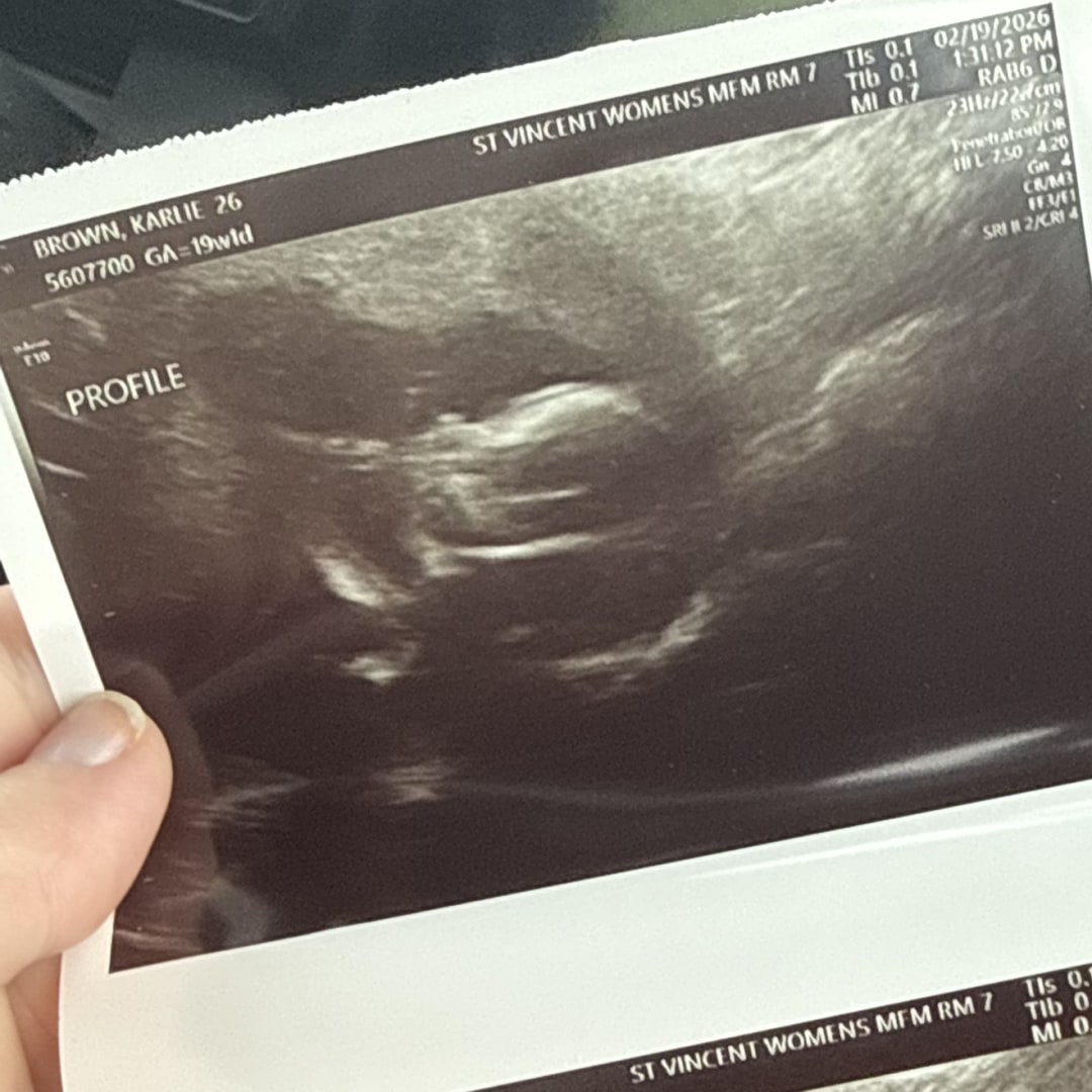 Photo shared by Nickolas for their Babylist baby registry.