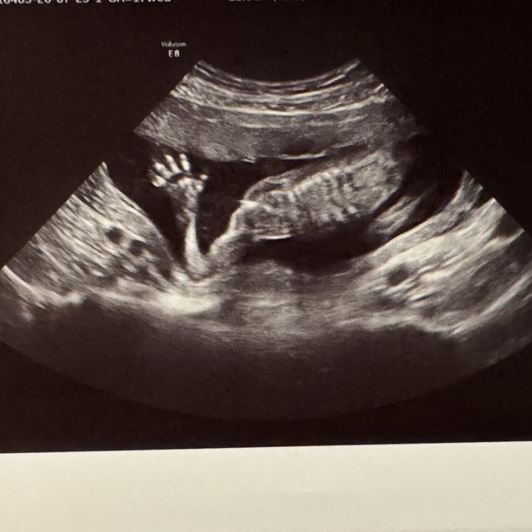 Photo shared by Brooklyn for their Babylist baby registry.
