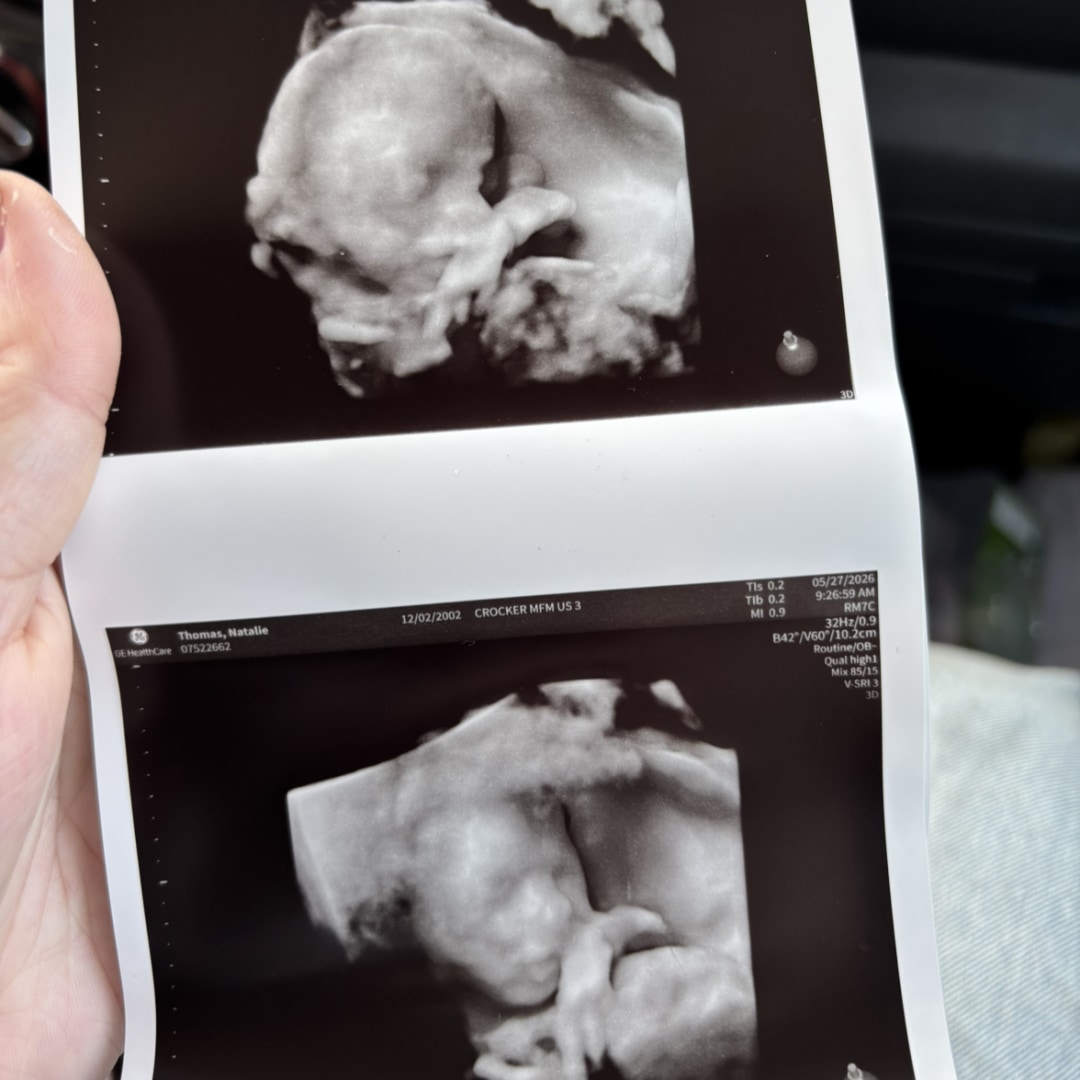 Photo shared by Natalie for their Babylist baby registry.
