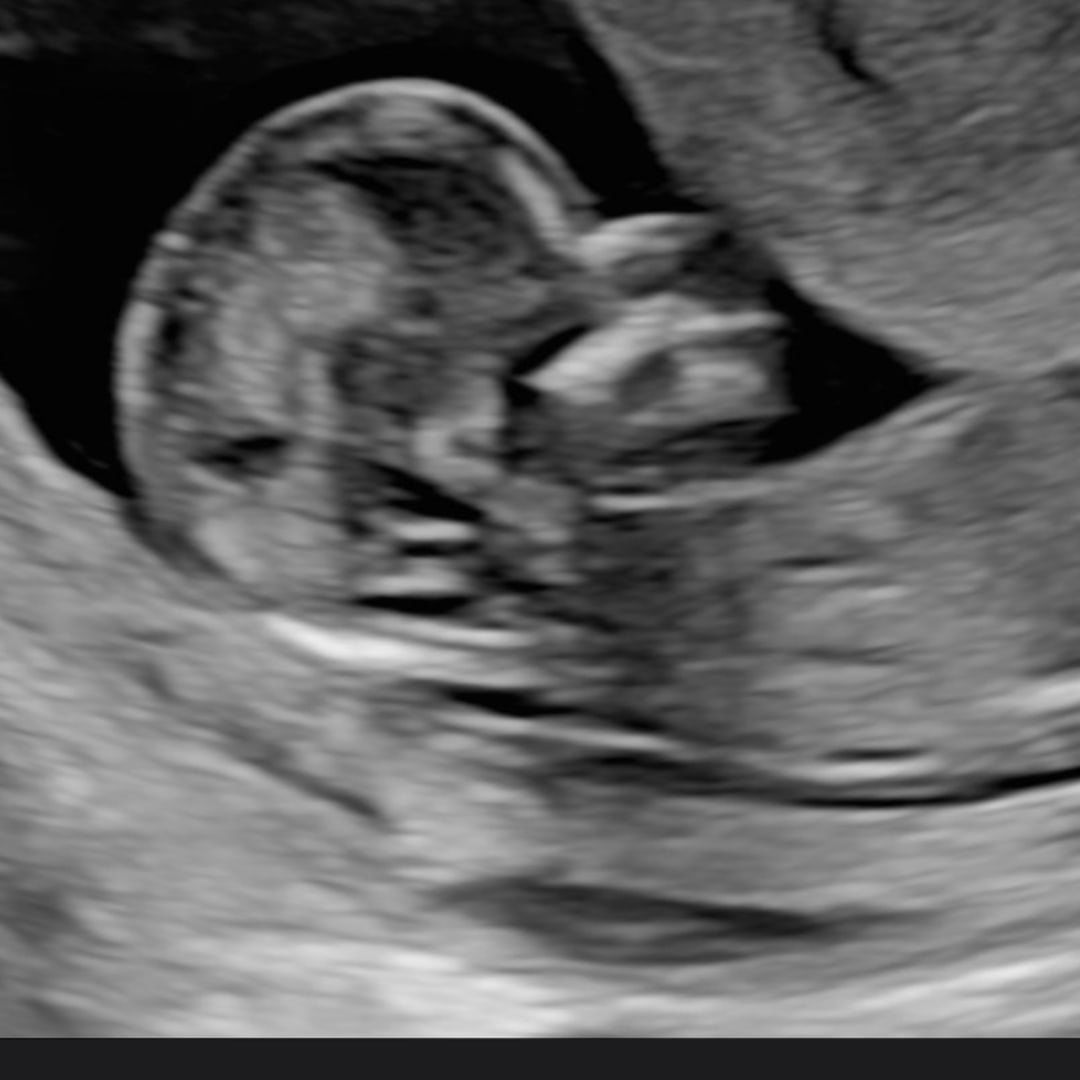 Photo shared by Kelsey for their Babylist baby registry.