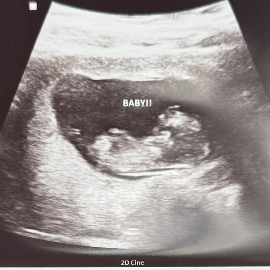 Photo shared by Dina for their Babylist baby registry.