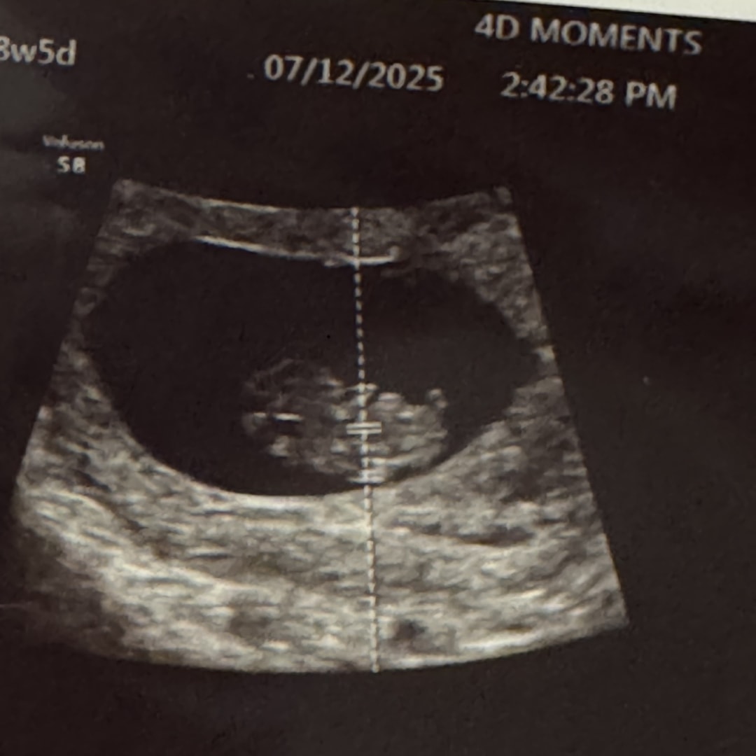 Photo shared by Melissa for their Babylist baby registry.