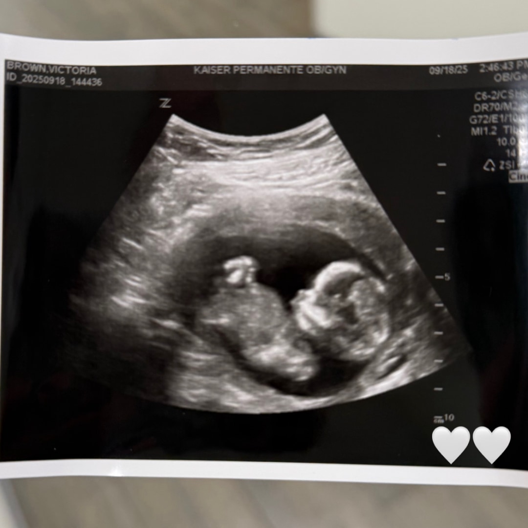 Photo shared by Victoria for their Babylist baby registry.
