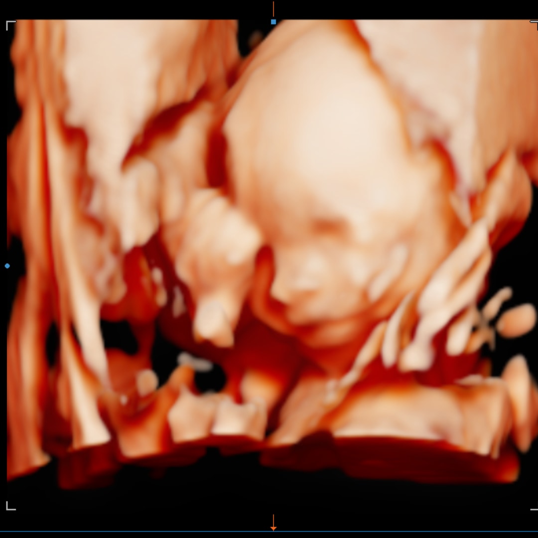 Photo shared by MaryJo for their Babylist baby registry.