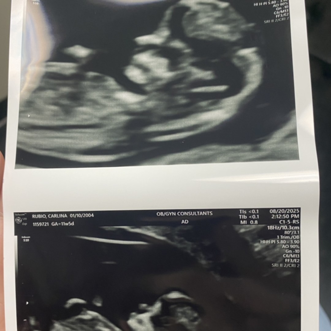 Photo shared by Carlina for their Babylist baby registry.