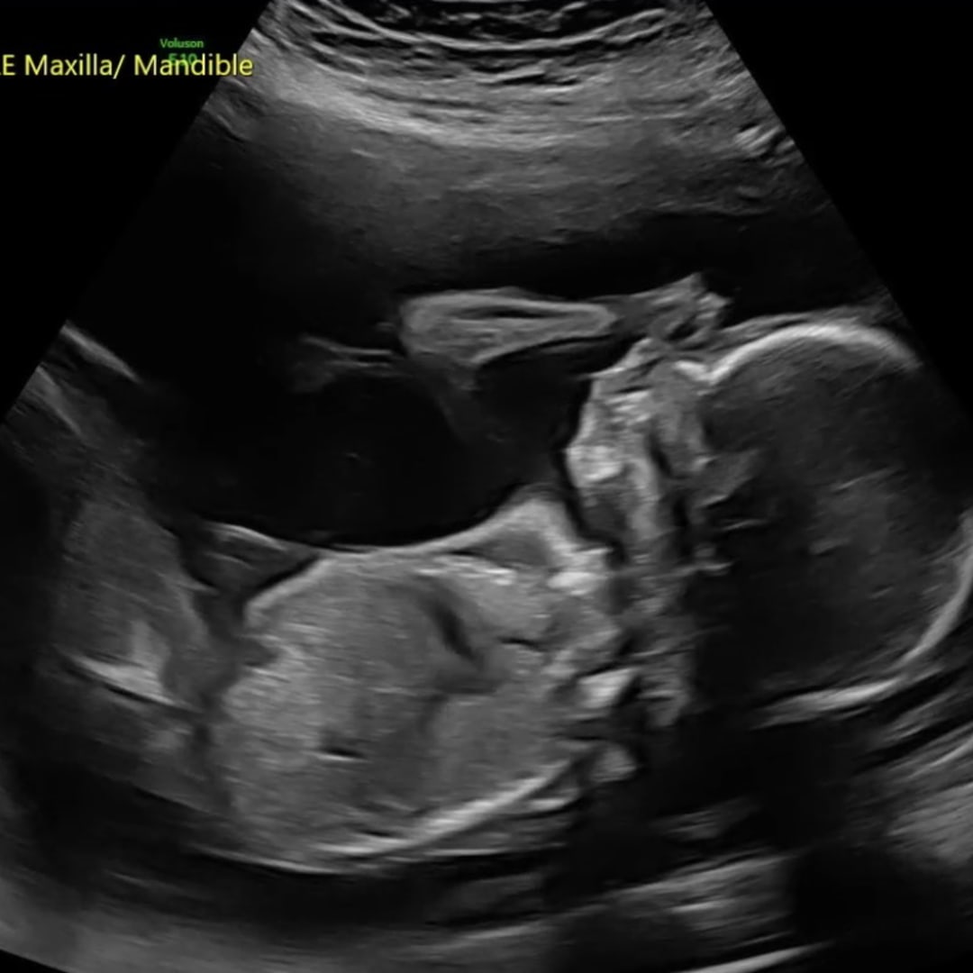 Photo shared by McKenzie for their Babylist baby registry.