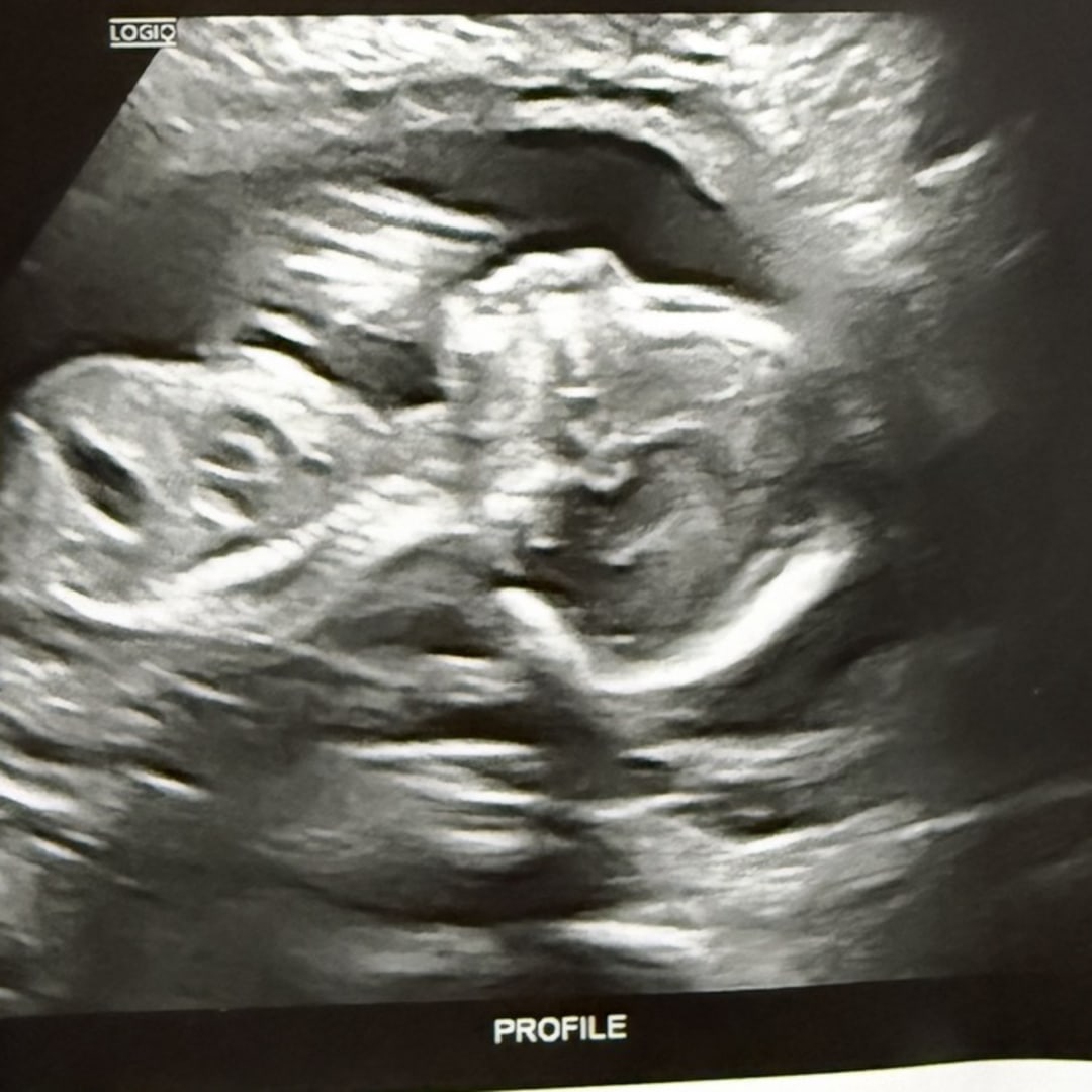 Photo shared by Mariah for their Babylist baby registry.
