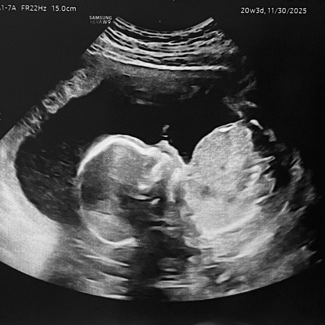 Photo shared by Kierstin for their Babylist baby registry.