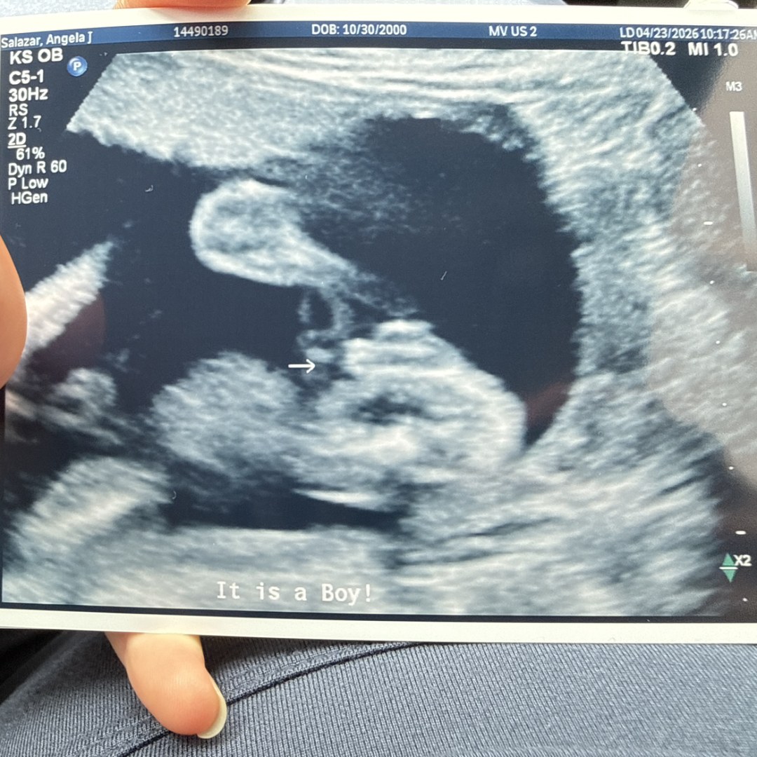 Photo shared by Angela for their Babylist baby registry.