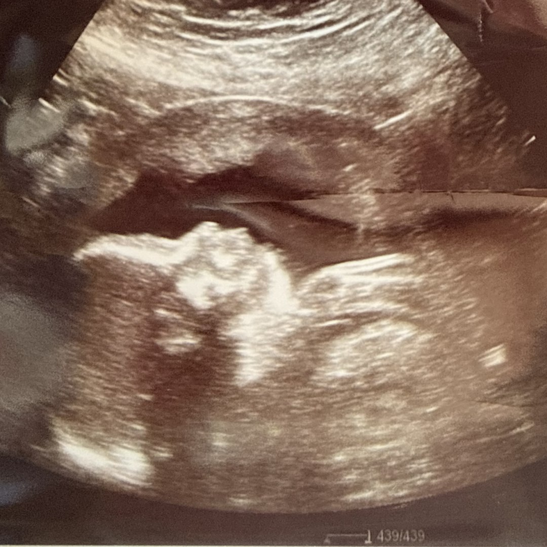 Photo shared by Brittany for their Babylist baby registry.