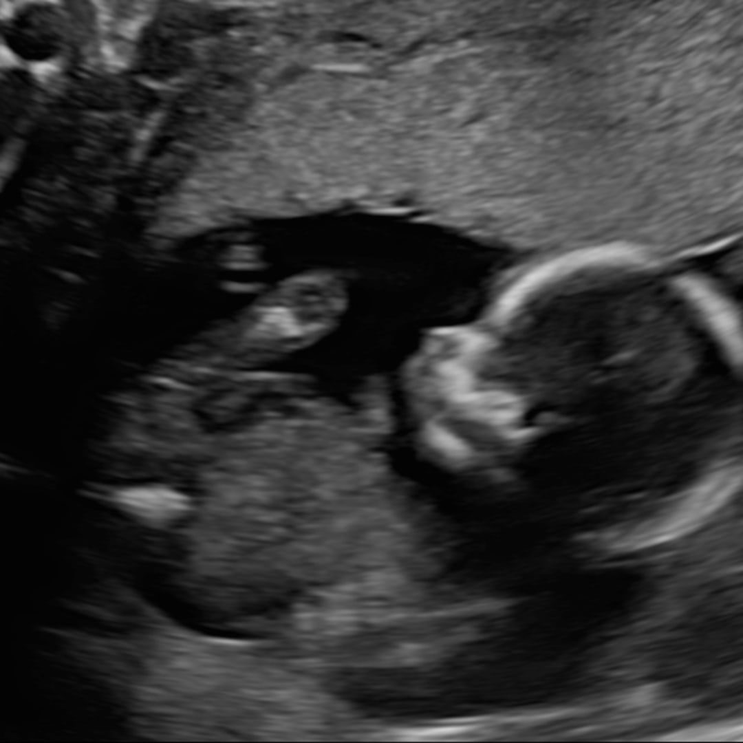 Photo shared by Alayna for their Babylist baby registry.