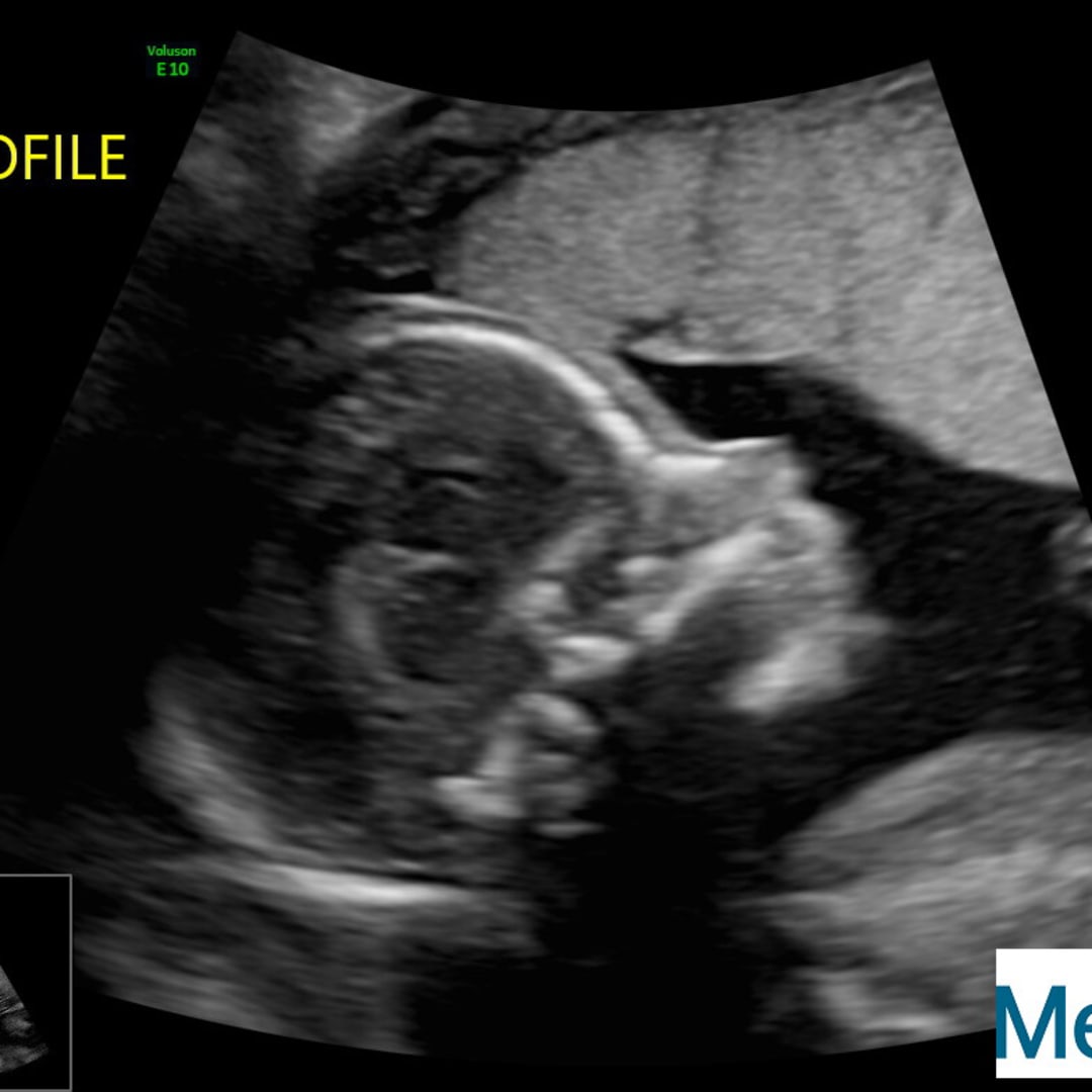 Photo shared by Jaira for their Babylist baby registry.