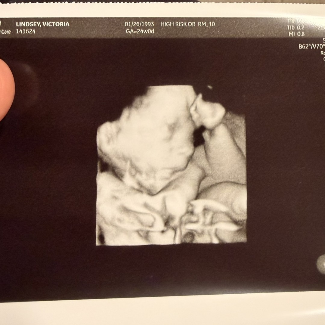 Photo shared by Victoria for their Babylist baby registry.