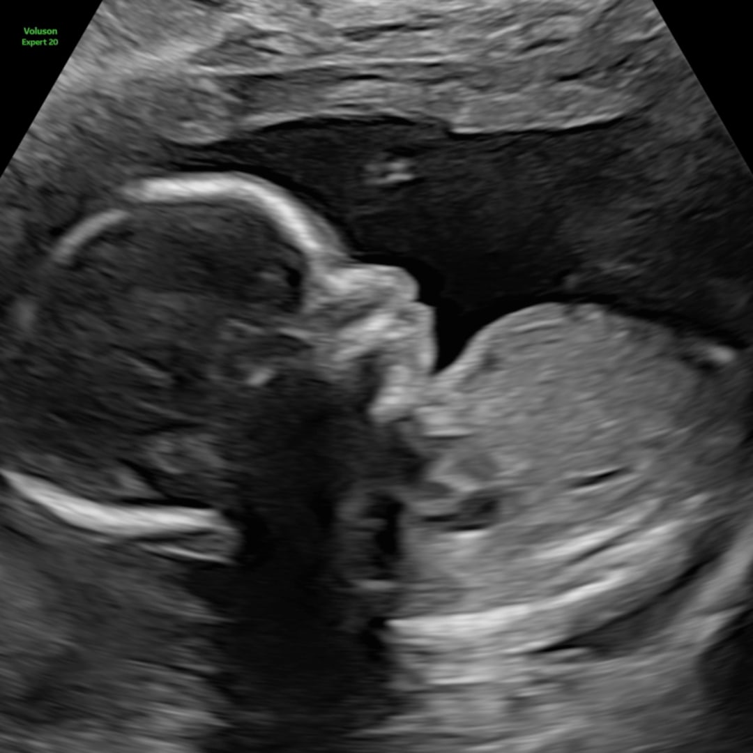 Photo shared by Abby for their Babylist baby registry.