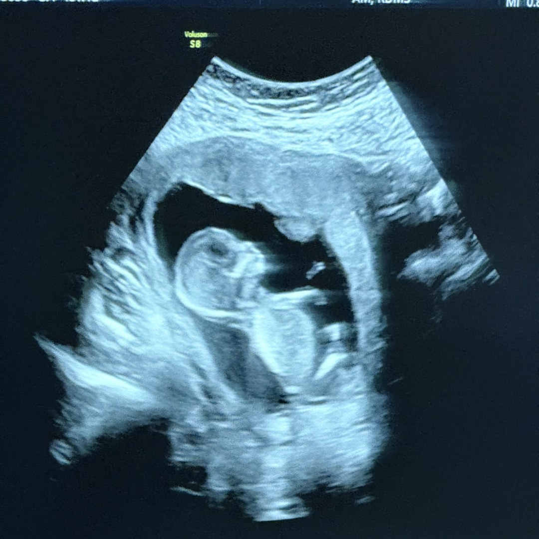 Photo shared by Martika & Anthony for their Babylist baby registry.