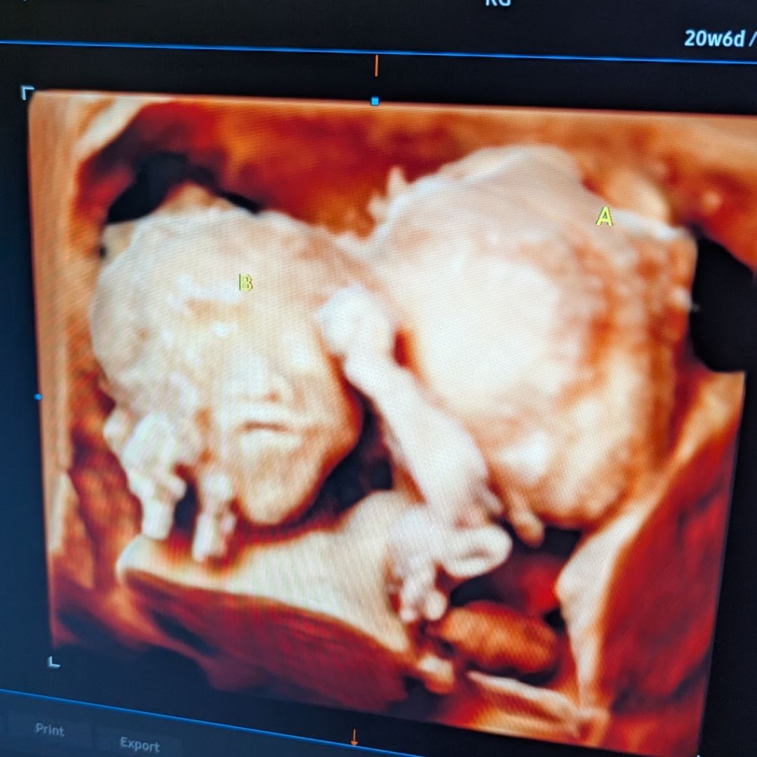 Photo shared by Alexandra for their Babylist baby registry.