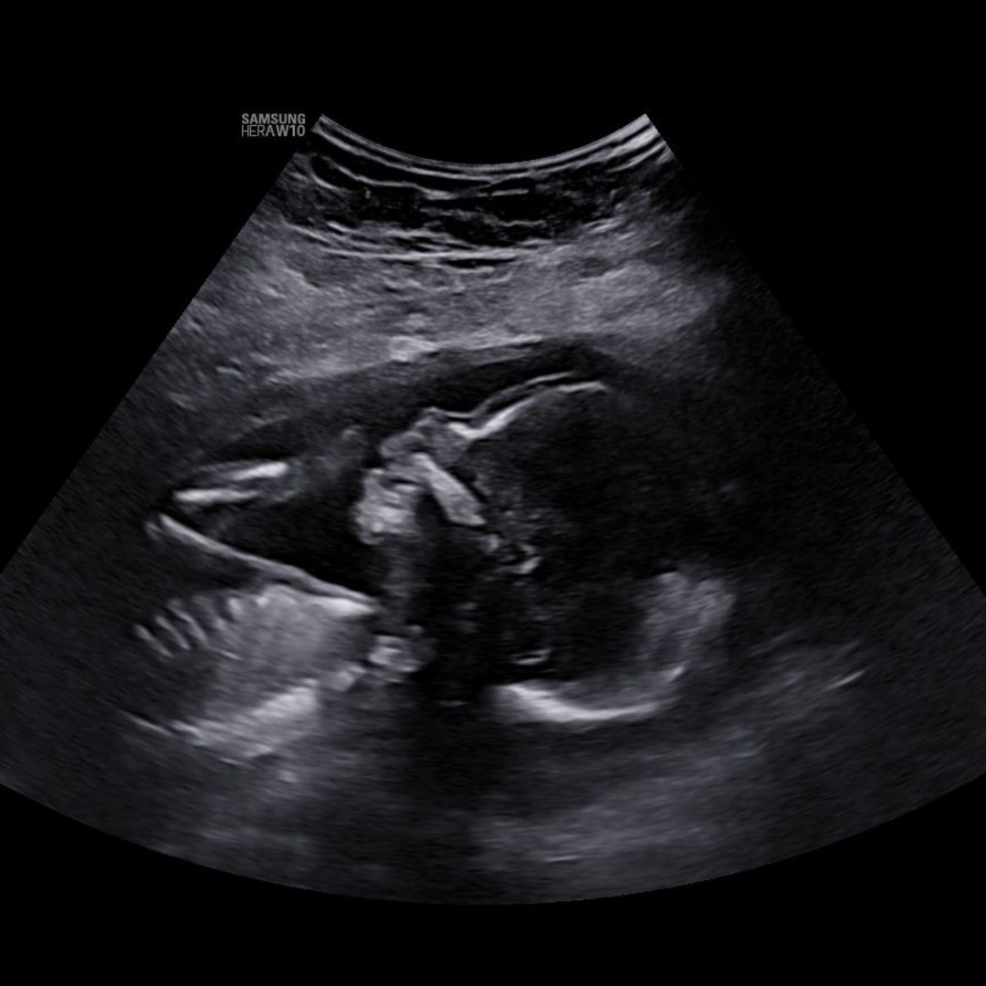 Photo shared by Janna for their Babylist baby registry.