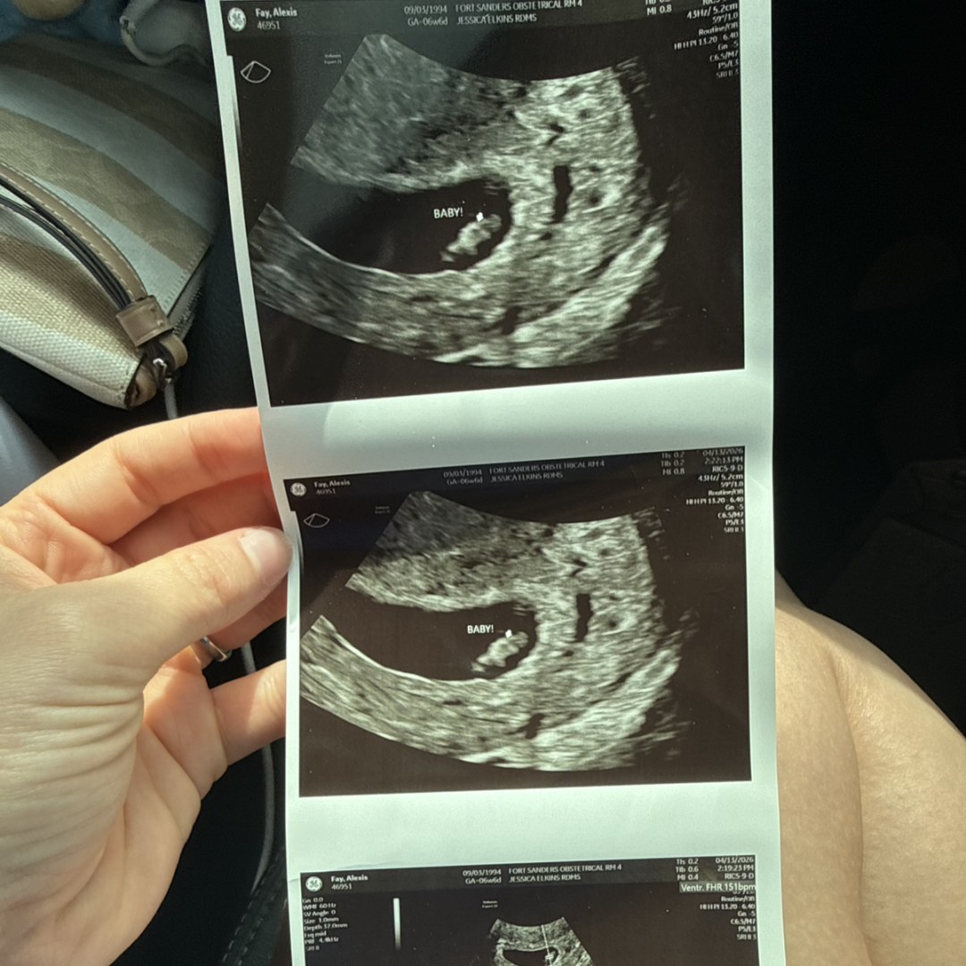 Photo shared by Alexis for their Babylist baby registry.