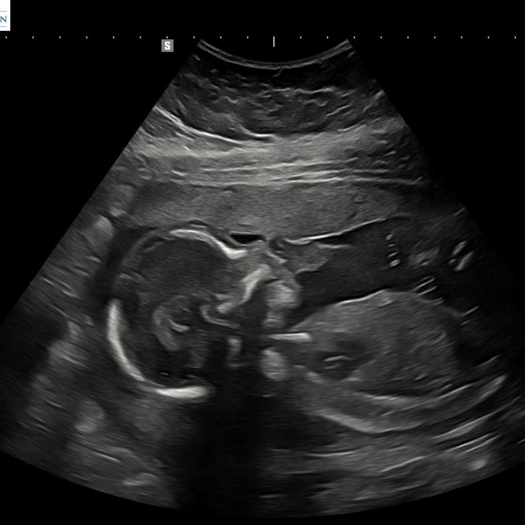 Photo shared by Hannah for their Babylist baby registry.