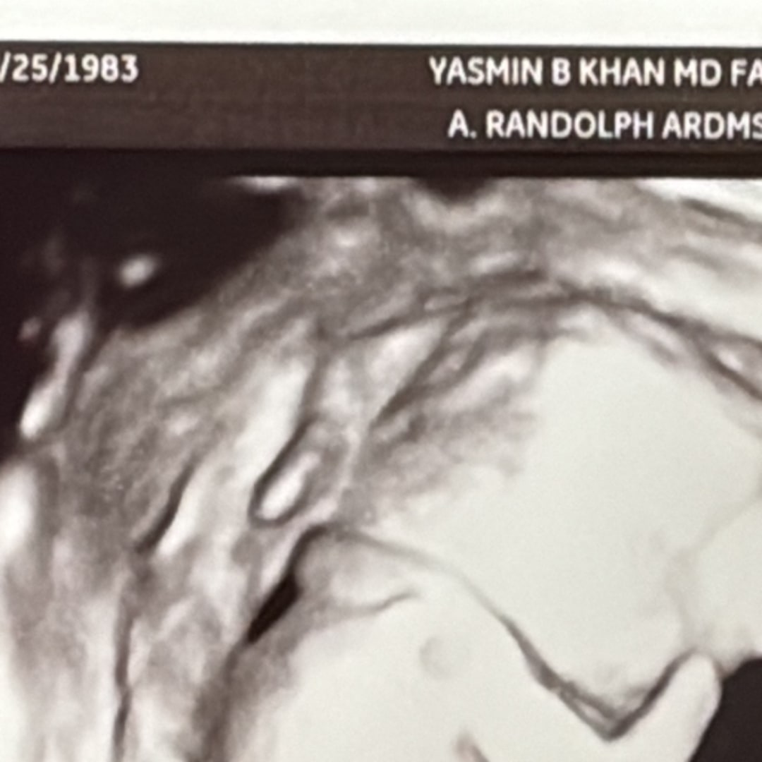 Photo shared by Victoria for their Babylist baby registry.