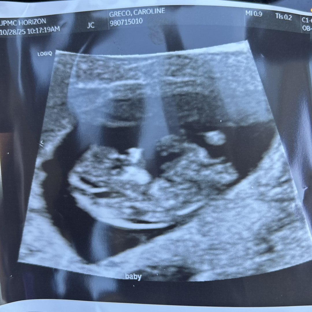 Photo shared by Caroline for their Babylist baby registry.