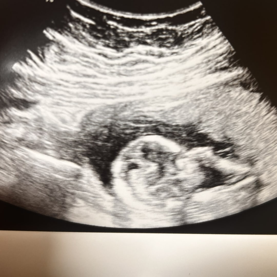 Photo shared by Kyleigh for their Babylist baby registry.
