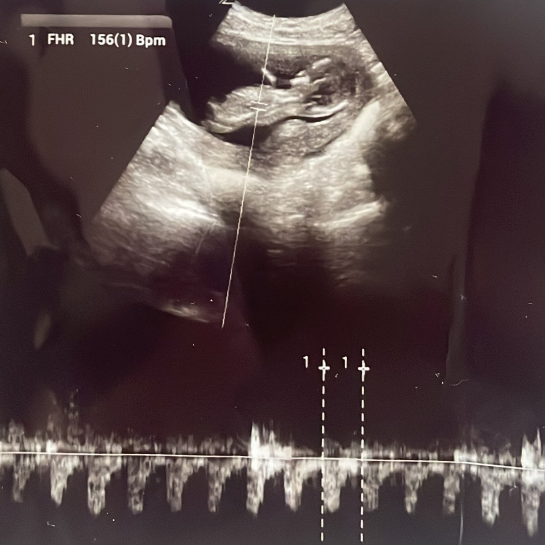 Photo shared by Elysse for their Babylist baby registry.