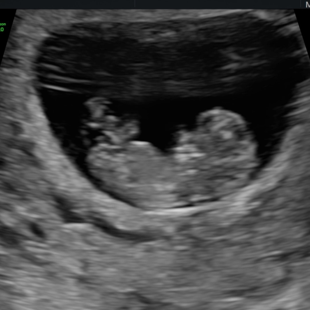 Photo shared by Rachel for their Babylist baby registry.