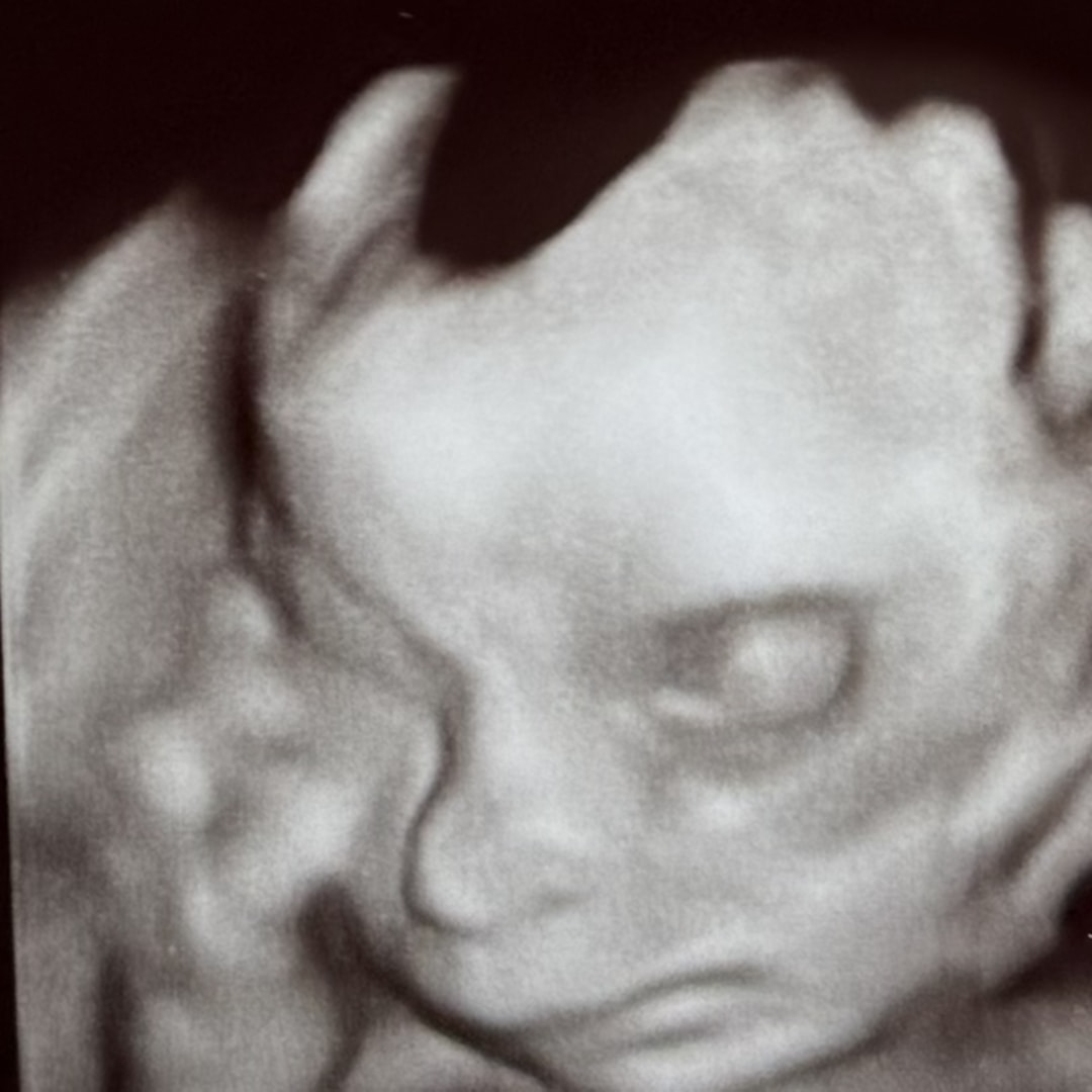 Photo shared by Chloe for their Babylist baby registry.