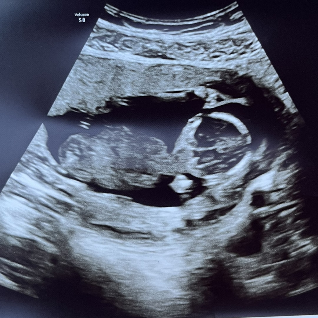 Photo shared by Jessica for their Babylist baby registry.