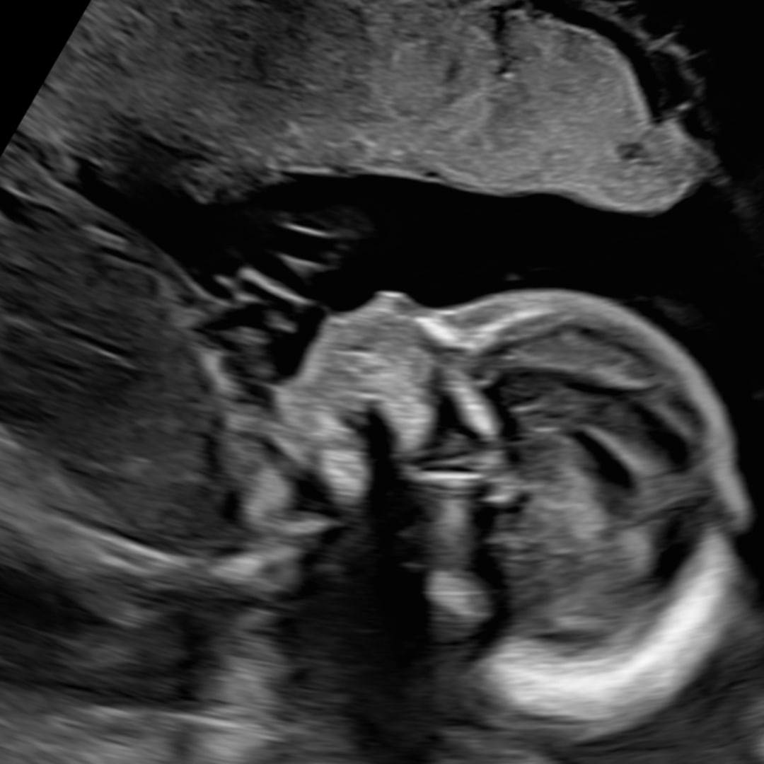 Photo shared by Devine for their Babylist baby registry.