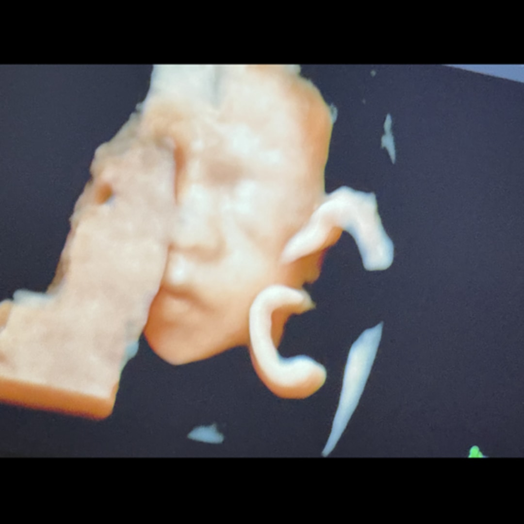 Photo shared by Jade for their Babylist baby registry.