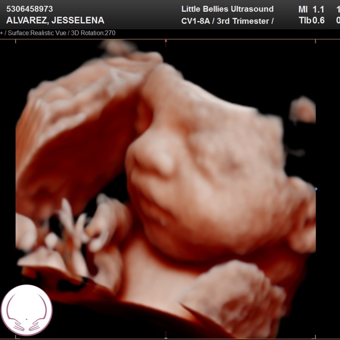 Photo shared by Jesselena for their Babylist baby registry.