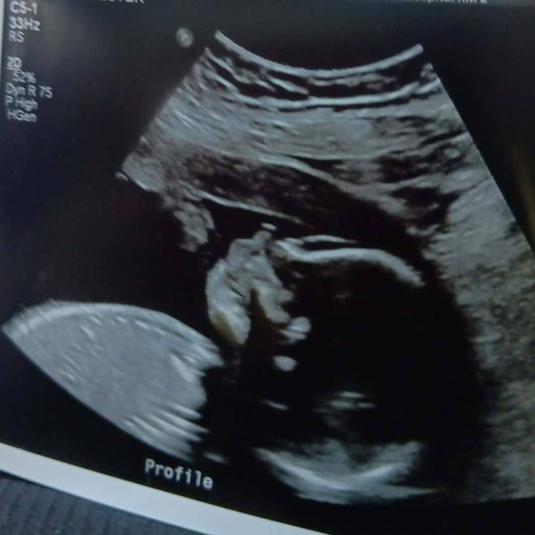 Photo shared by Gretchan for their Babylist baby registry.