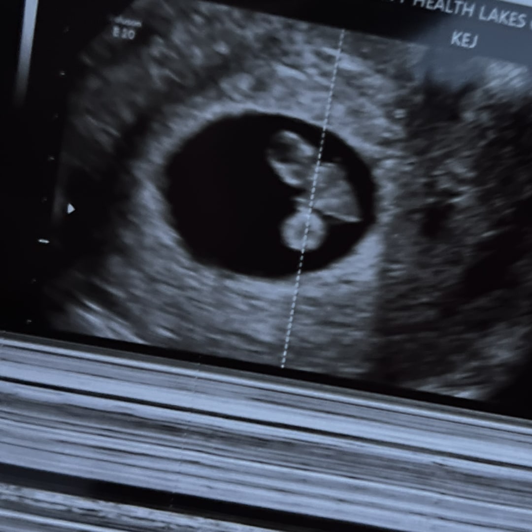 Photo shared by Lauren for their Babylist baby registry.