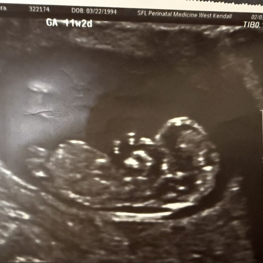 Photo shared by Laura for their Babylist baby registry.